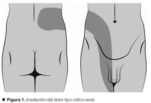 Dolor Lumbar