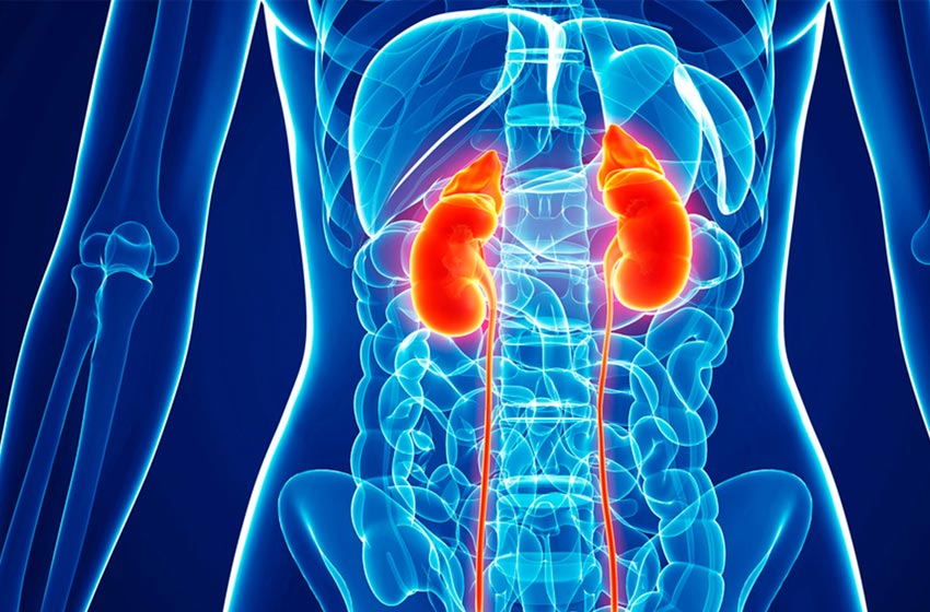 Cáncer de Riñón