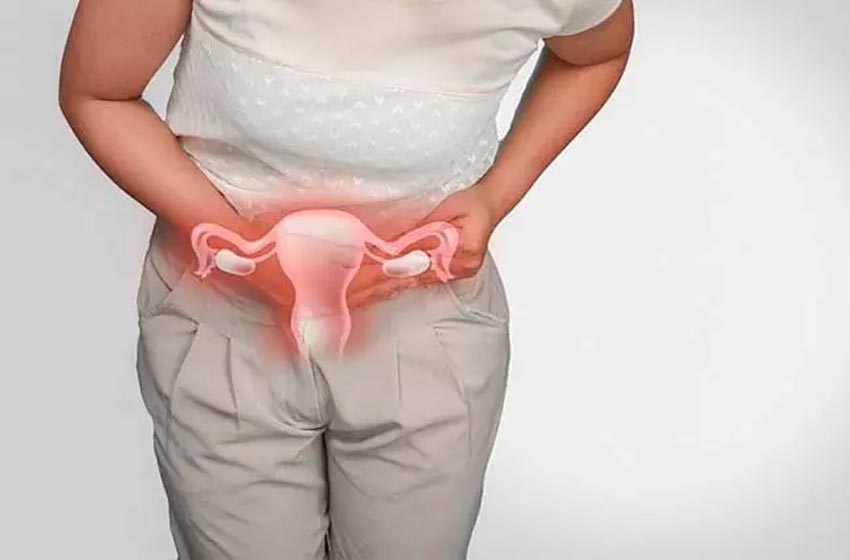Prolapso Uterino