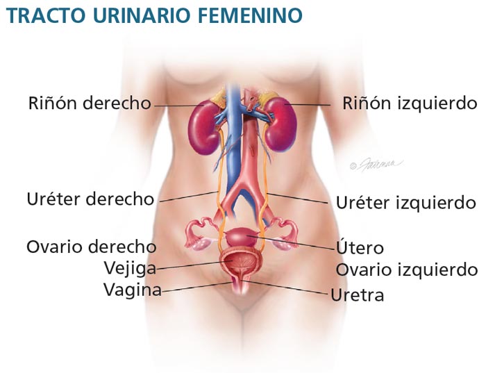 Incontinencia Urinaria