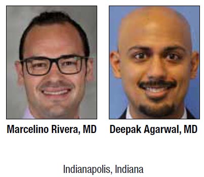 Urólogo en Cali cálculos urinarios