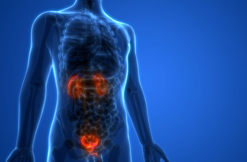 Urologo en Cali cancer de vejiga