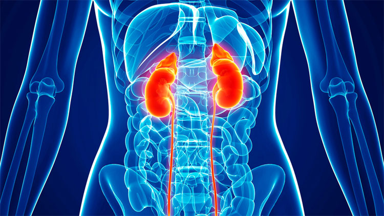 Utilidad de la Ecografía para la detección del nivel de trombos en la vena cava inferior en pacientes con Cáncer de Riñón