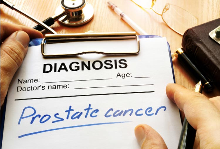 ¿Es hereditario el cáncer de próstata?