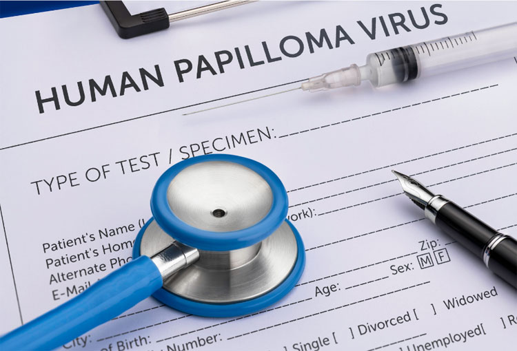 ¿En qué complicaciones puede derivar el Virus del Papiloma Humano?