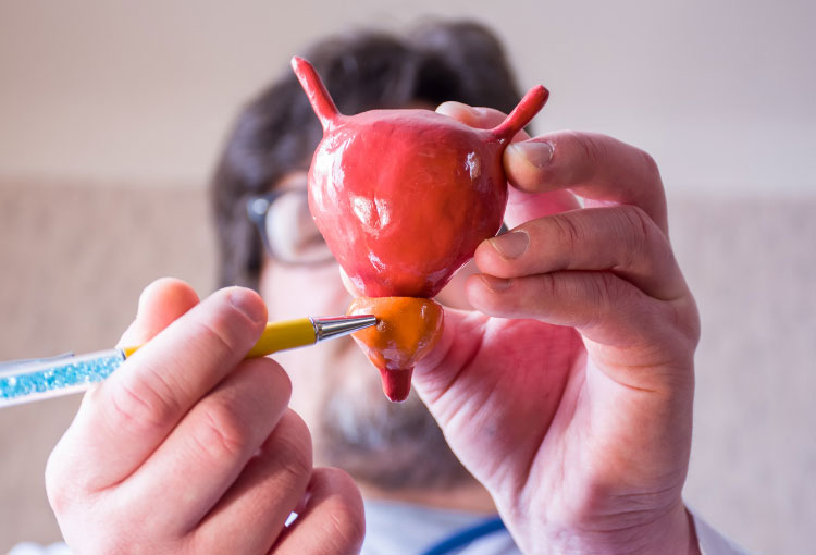 Enfermedades prostáticas más comunes después de los 40